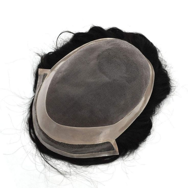 پروتز مو مردانه