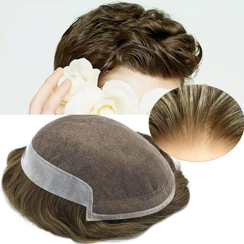 پروتز مو مردانه