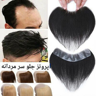پروتز مو جلو سر