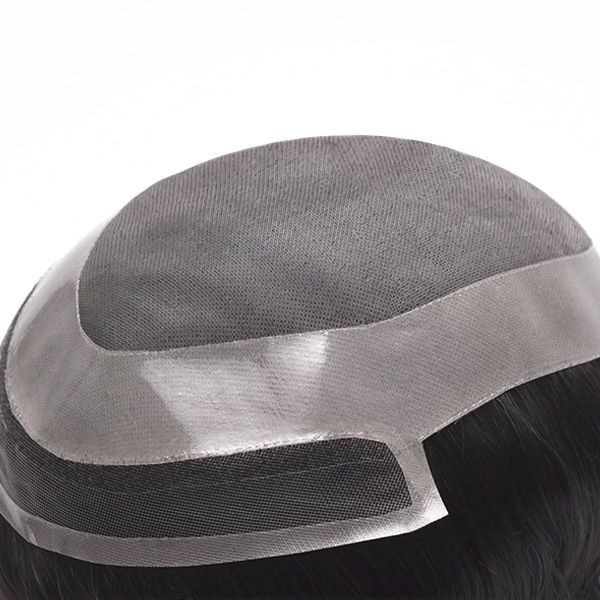 پروتز آنکارایی