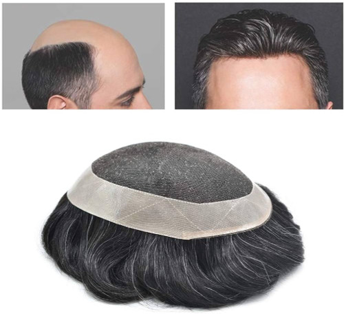 پروتز مو مردانه نیوزلندی