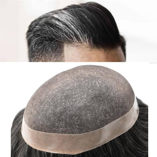 پروتز مو مردانه دورپوست