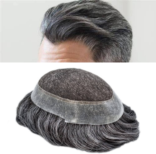 پروتز مو دور پوست
