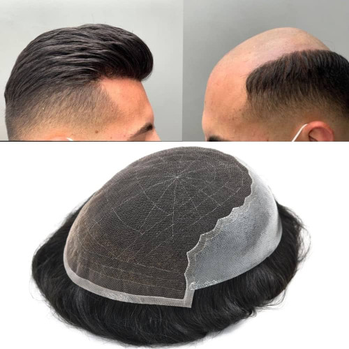پروتز مو وارداتی