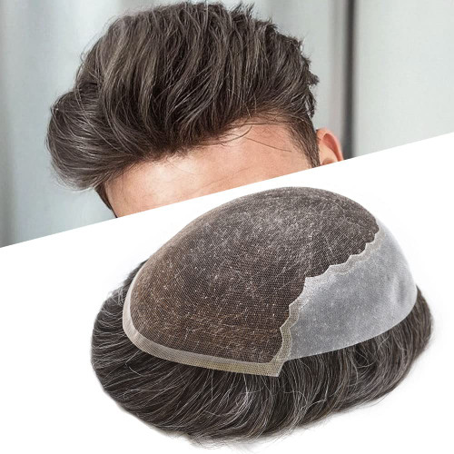 خربد پروتز مو مردانه