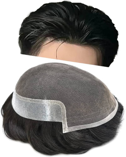 عوارض پروتز مو