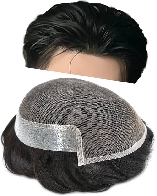 عوارض پروتز مو