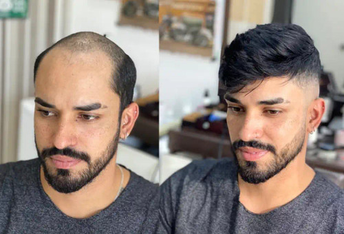 کلاه گیس موی مردانه