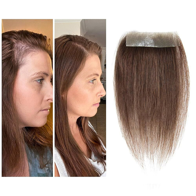 پروتز جلو سر زنانه با موی طبیعی