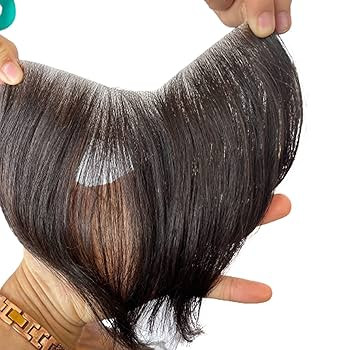 درمان ریختگی جلو سر زنانه