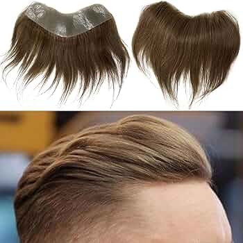 پروتز شقیقه مردانه