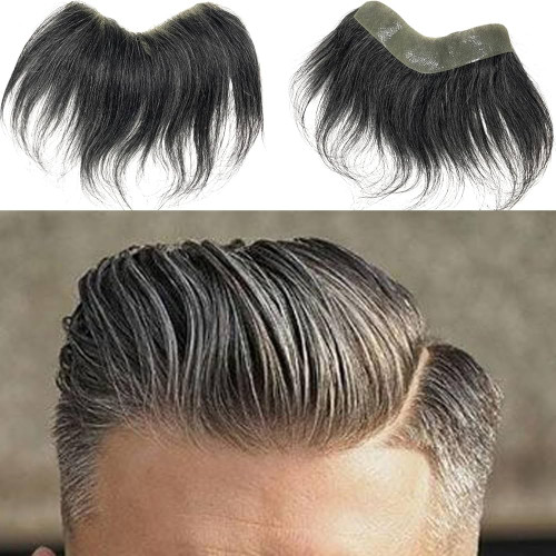 پروتز شقیقه مردانه